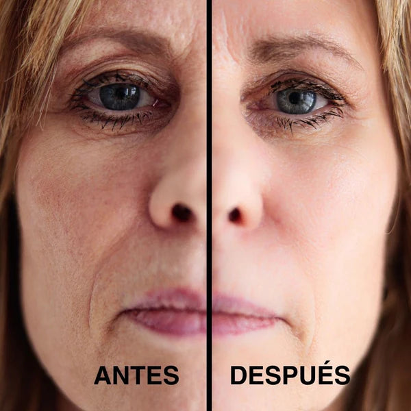 Parches Anti-arrugas Secret Lift® (OFERTA 40% SOLO POR HOY)